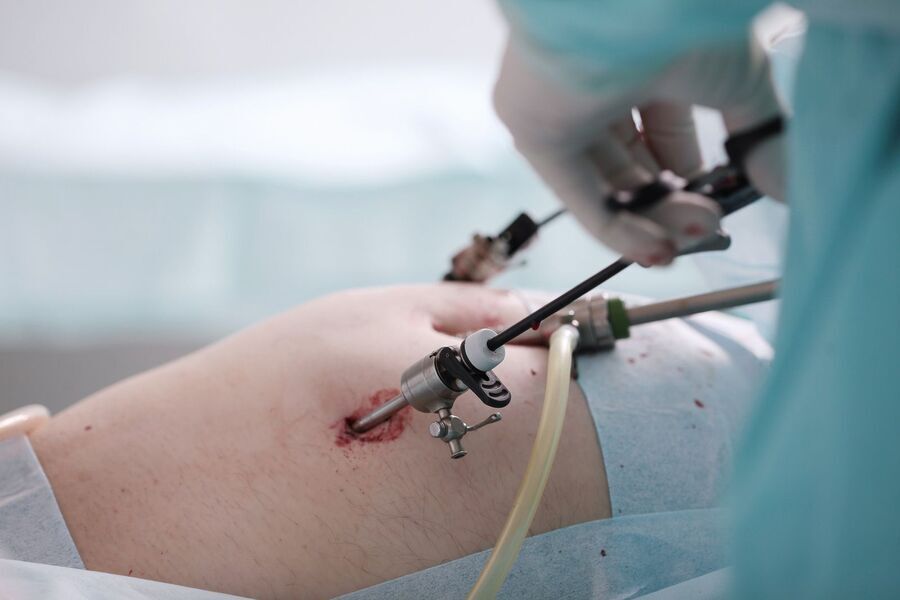 Minimal-invasive Chirurgie